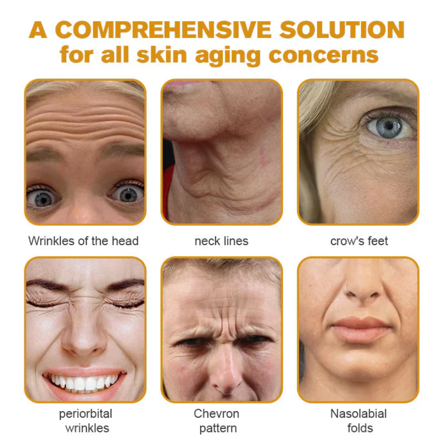 Botox Bee Venom Wrinkle Removal Cream